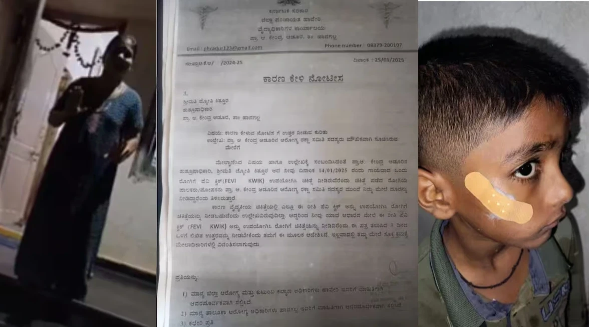 कर्नाटक में नर्स द्वारा घाव पर टांके लगाने की बजाय 'फेवीक्विक' का इस्तेमाल करने का मामला, सरकार ने नर्स को निलंबित किया, बच्चा सुरक्षित।