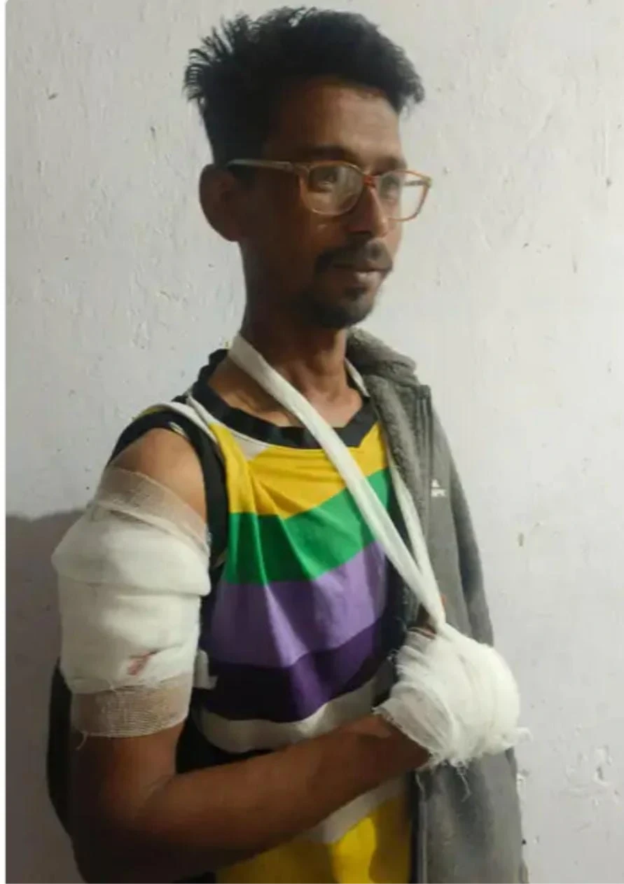 बाइक-एक्टिवा की टक्कर के बाद युवक को गोली मारी