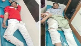 Raipur City News: राजधानी रायपुर के माना इलाके में पूर्व विधायक की गाड़ी से बाइक सवार युवकों की टक्कर होने से युवकों को गंभीर चोट आई हैं। पीड़ितों को उपचार के लिए अस्पातल में भर्ती कराया गया है।
