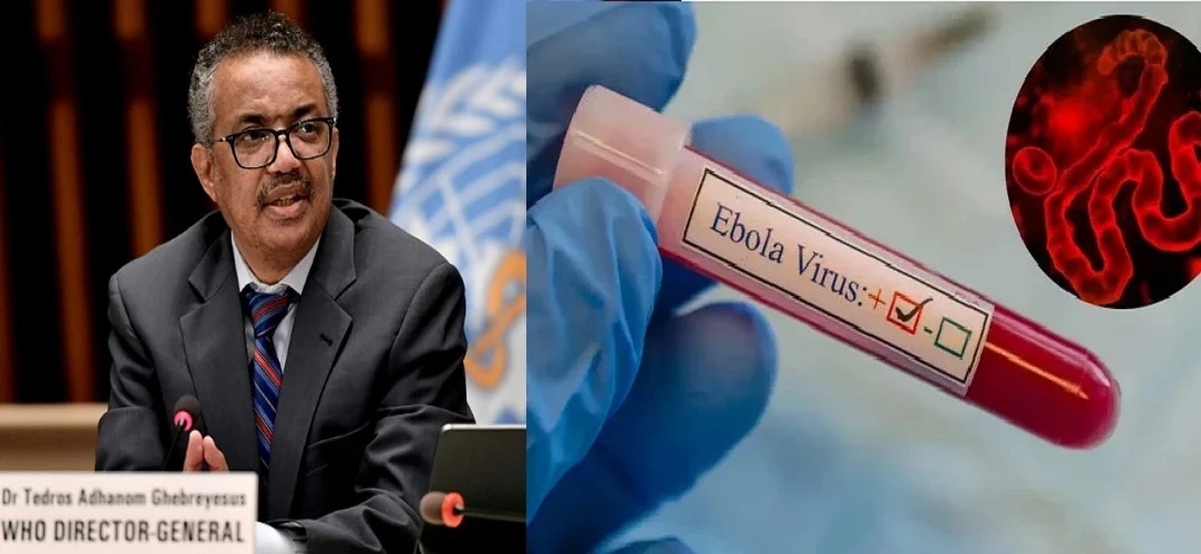 Ebola Virus