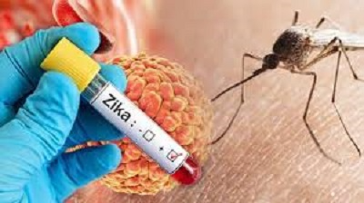 Zika Virus